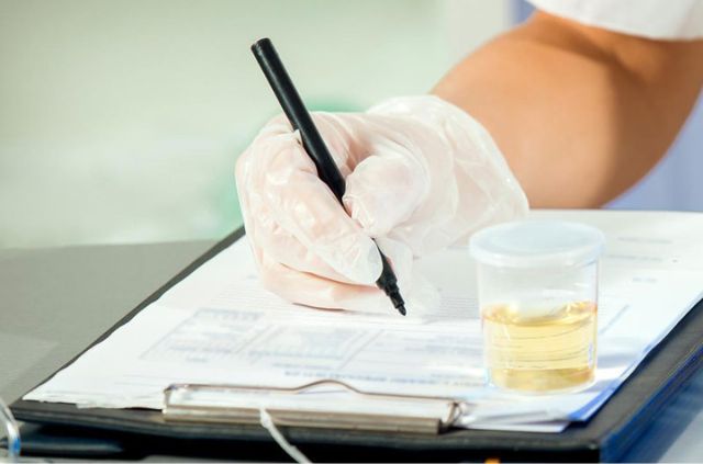 Xét nghiệm ma túy là một phương pháp quan trọng để xác định tình trạng sức khoẻ